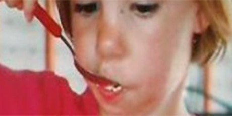 Reeducación de la motricidad bucofacial Reeducación de la motricidad bucofacial