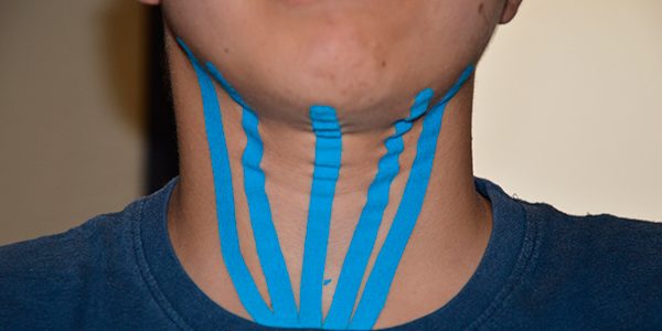 Vendaje neuromuscular