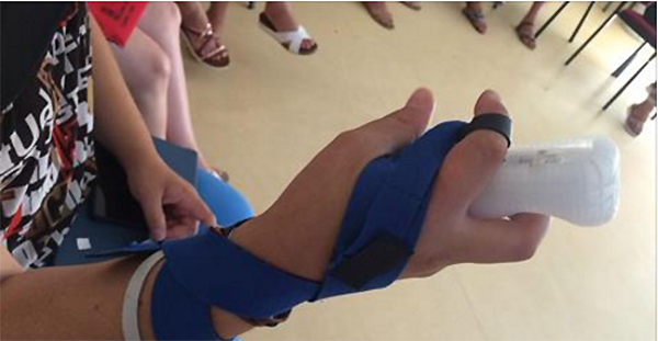 NNTT-en-neurorrehabilitacion