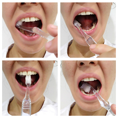 Procedimiento higiene oral