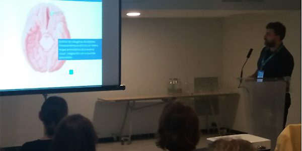 Alteraciones visuoespaciales y agnosias