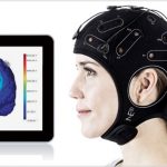 Neuromodulación no invasiva en el tratamiento del dolor asociado al parkinson