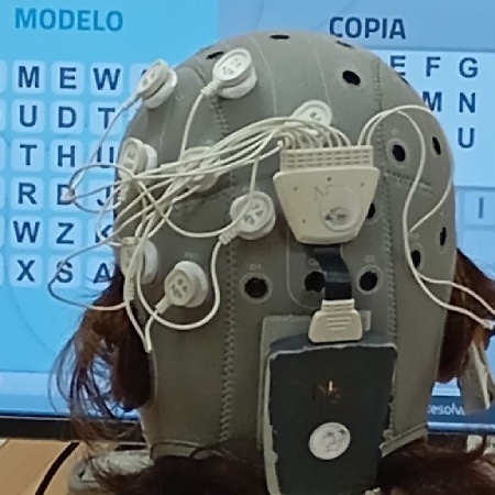 tDCS-2_BG