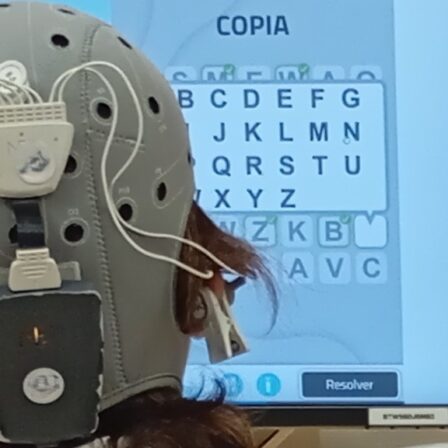 tDCS-3_BG